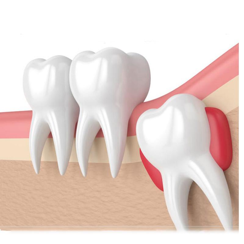 Gomulu Disler Dent Halikarnas